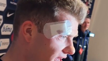 百家乐平台app-瑟尔洛特头部被撞后表示无碍：我没事，幸运的是没有脑震荡